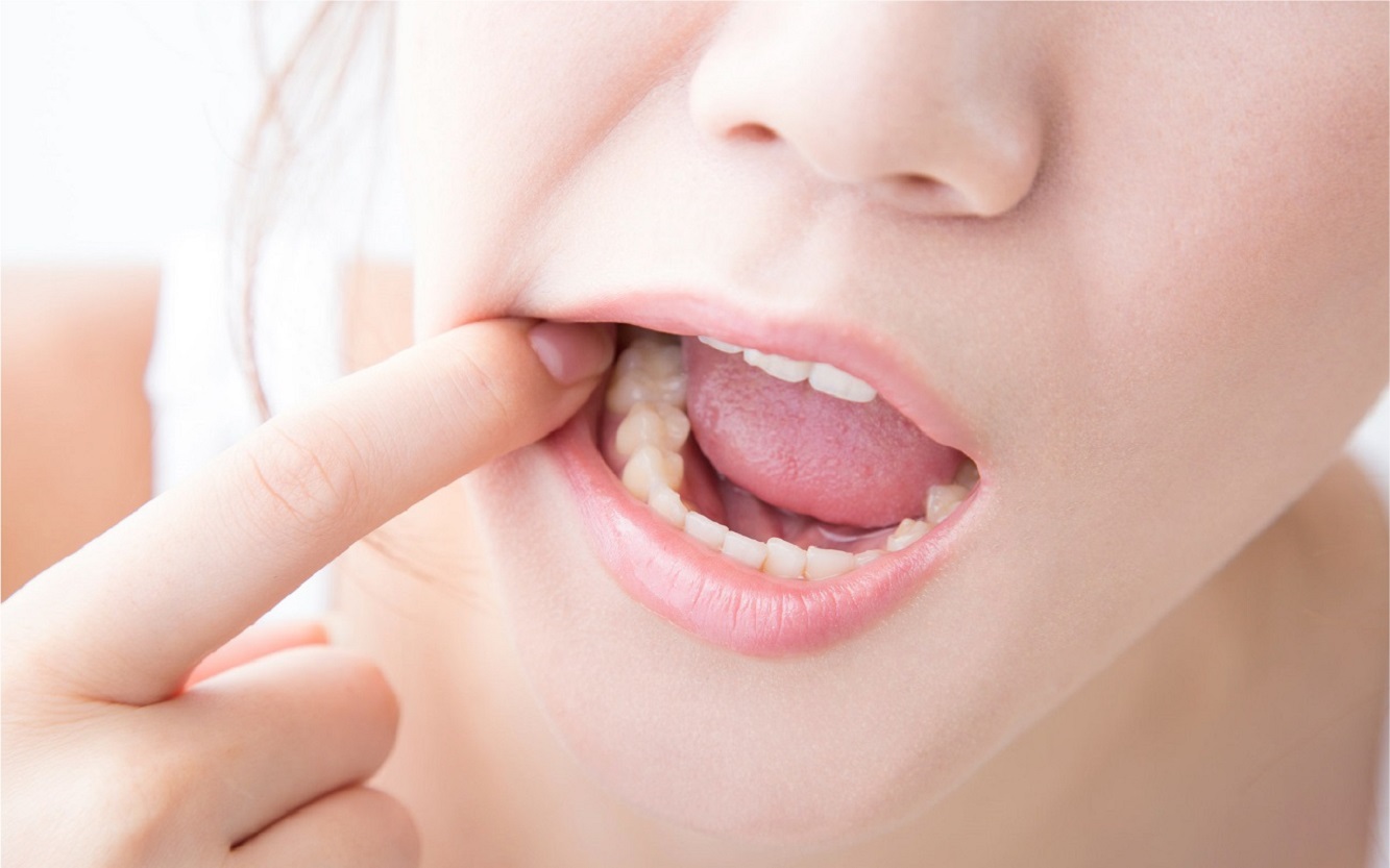 Handle Your Wisdom Teeth Issues
