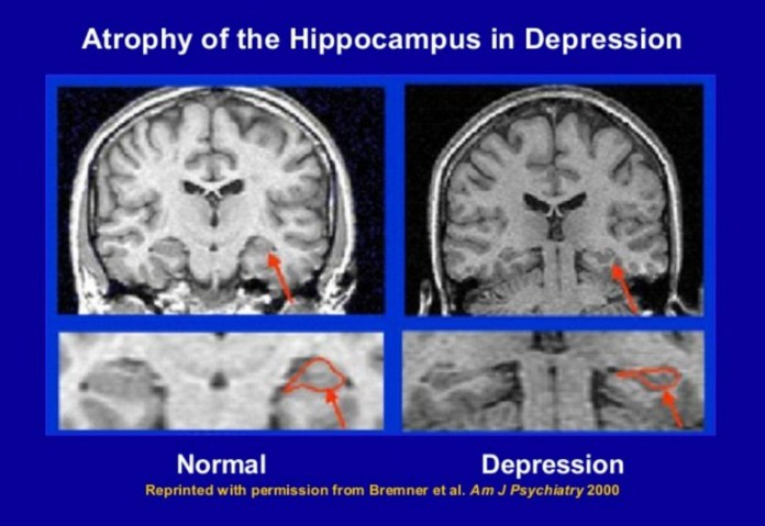 WhatsApp-Image-2018-08-19-at-20.32.48