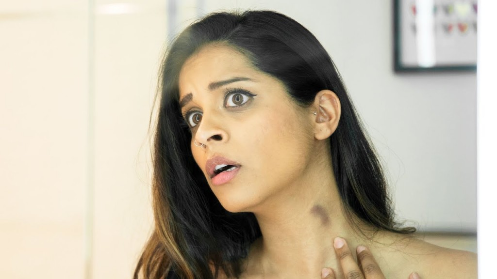 How To Get Rid Of A Hickey At Home?