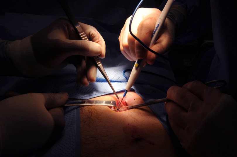 laparoscopic hernia repair