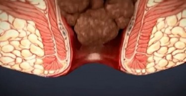 Internal Piles