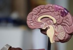 Epidural Hematoma Cerebral Palsy