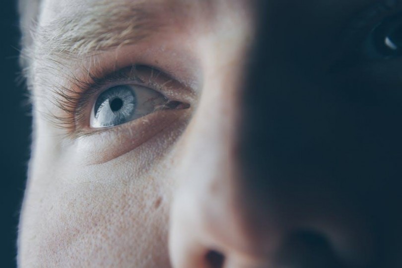 Bags Under Eyes
