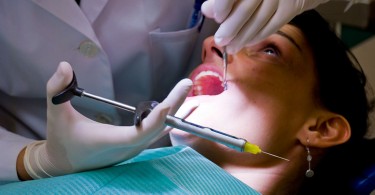 Cavity Filling