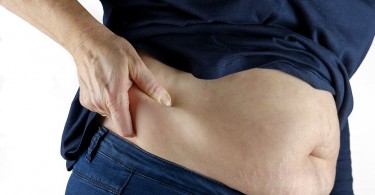 How To Find Some Chilling Deals On Coolsculpting