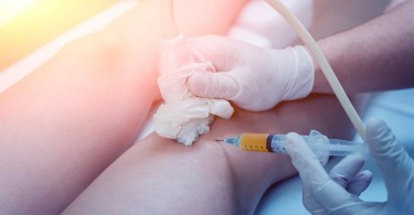 Platelet Rich Plasma Therapy