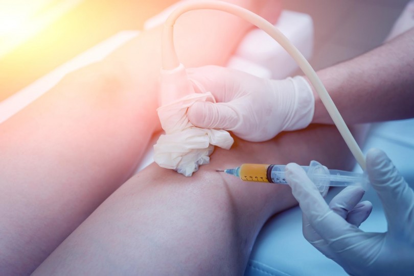 Platelet Rich Plasma Therapy
