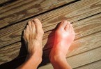 Lower Uric Acid