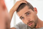 Hair Loss In Men