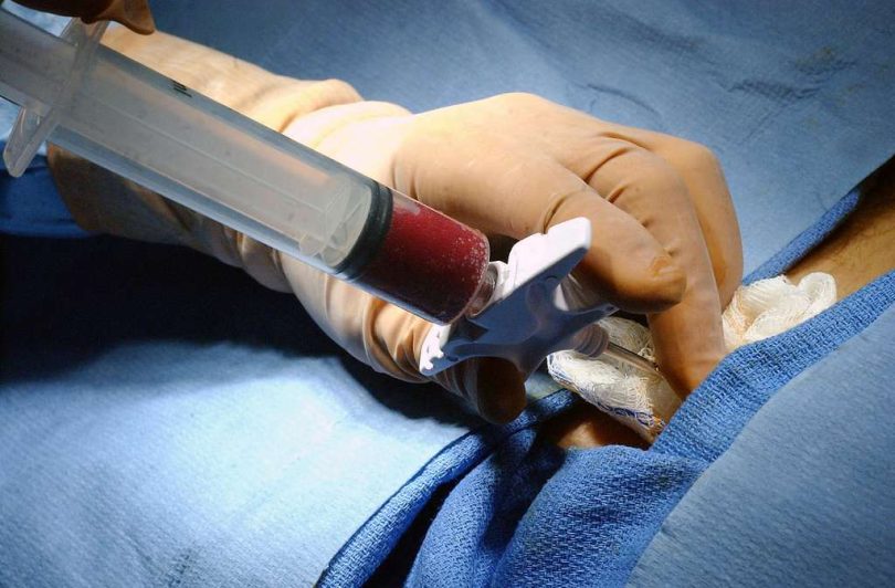 What Is A Bone Marrow Transplant